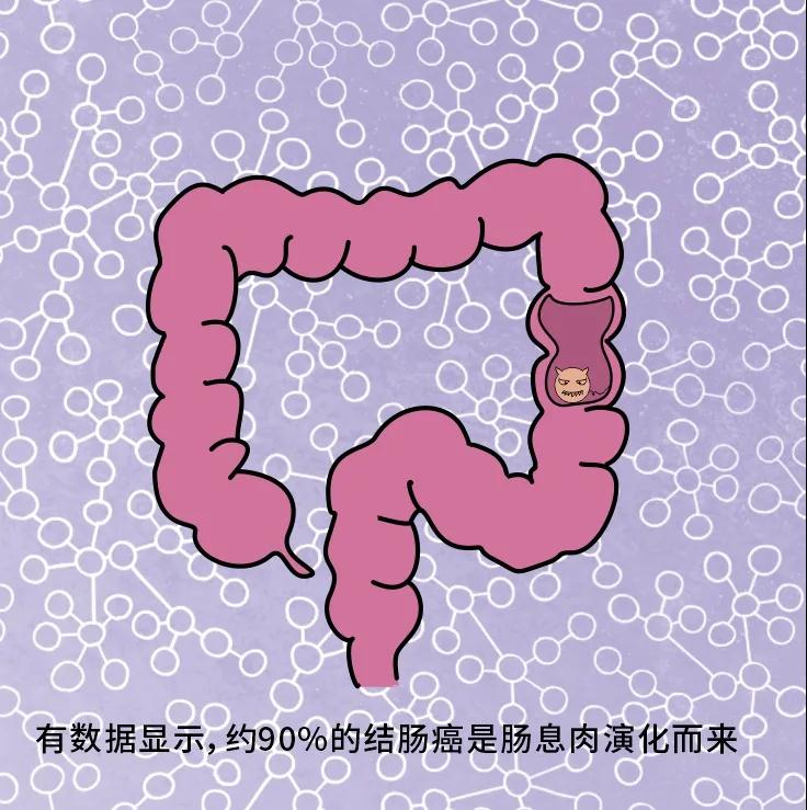 奪走“黑豹”生命的結(jié)腸癌，到底什么來頭？