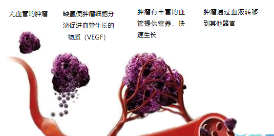 晚期腫瘤為什么會(huì)復(fù)發(fā)轉(zhuǎn)移？