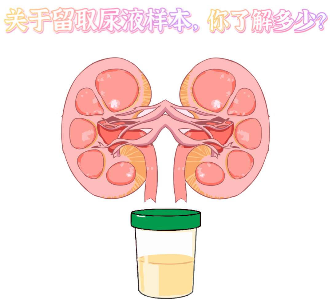做尿檢，不得不說的注意事項！