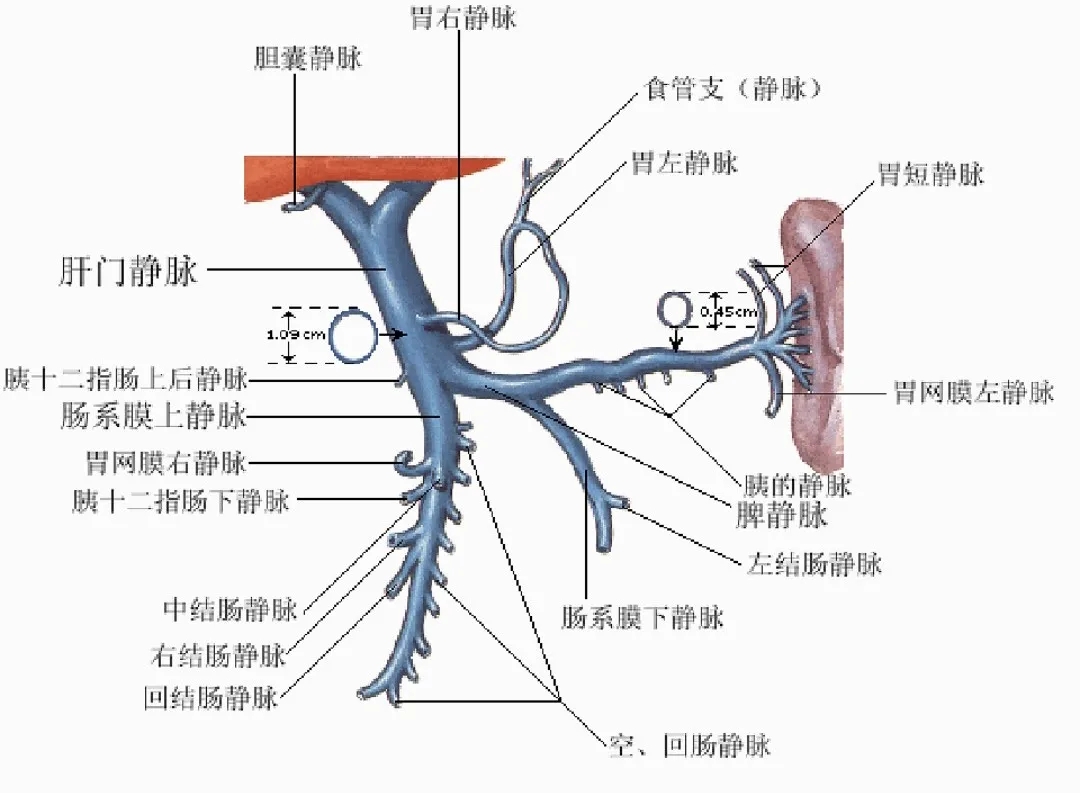 反復嘔血、黑便怎么辦？TIPS手術能解決
