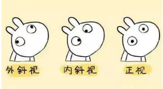 小baby老歪著頭？警惕斜頸! 這樣糾正……