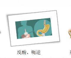 關(guān)愛身體健康，輕松檢查胃腸